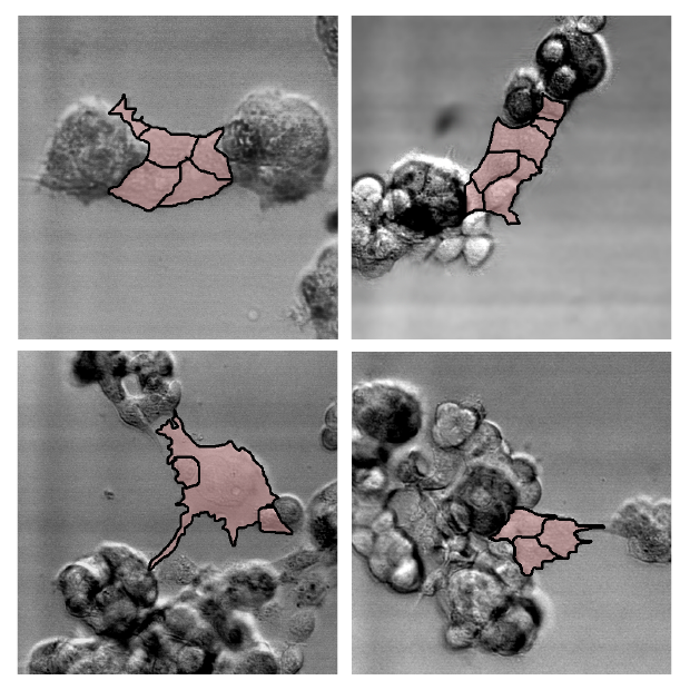 Cancer cells merging together via bridges