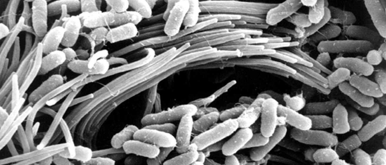 bacteria (Pseudomonas aeruginosa) on the surface of a CF-affect airway.
