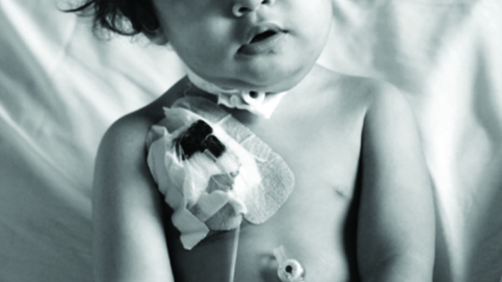 young child sitting in bed with dressing covering insertion site on chest