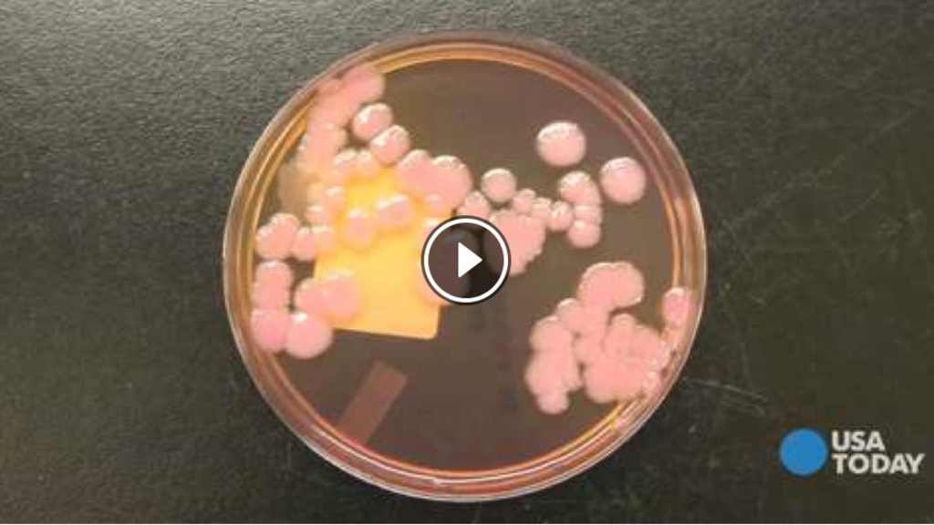 an image of bacteria in a lab setting