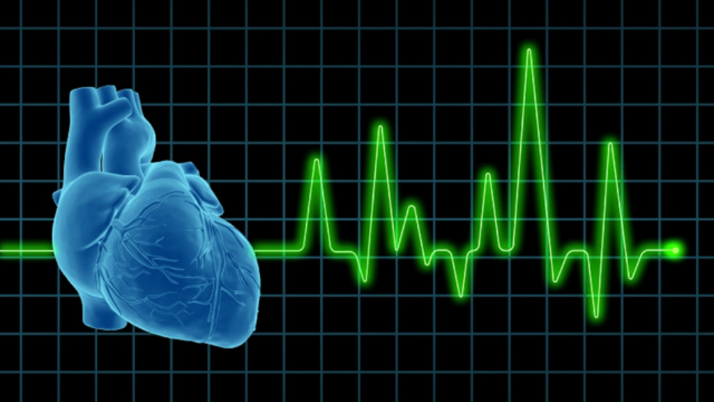 Image of a electrocardiogram (ECG / EKG), with human heart on screen. 