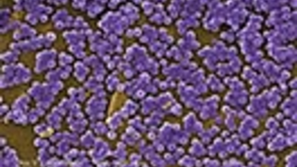 Magnified methicillin-resistant Staphylococcus aureus bacteria. Photo provided by CDC.