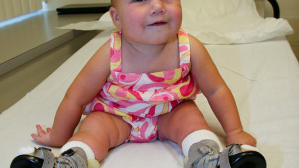 child with leg braces