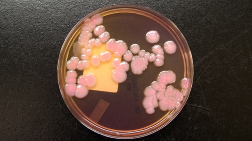 A lab specimen of antibiotic-resistant Enterobacter cloacae, which belongs to a family of infectious bacteria, known as CRE. / Handout