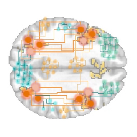 A graphic depiction of circuits in a brain