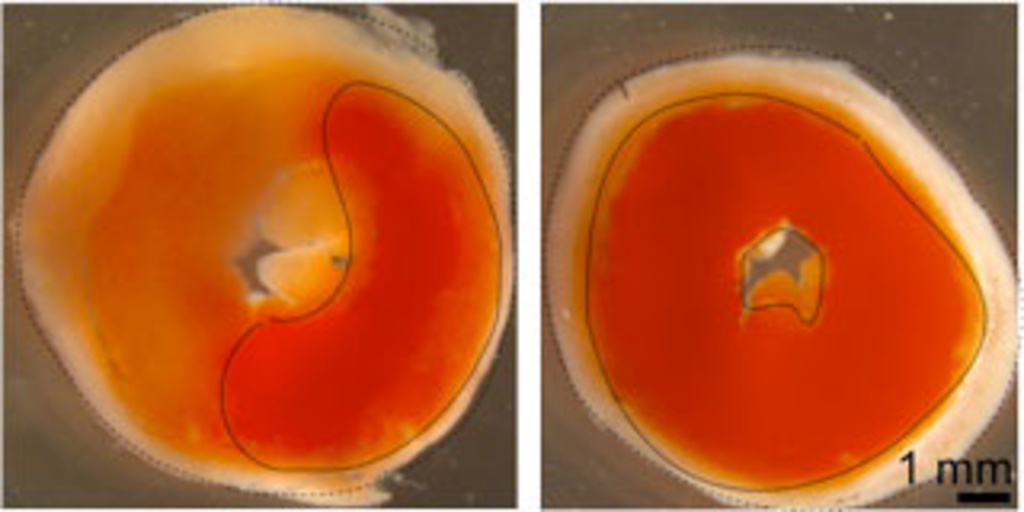 enzyme-triggers-heart-failure-iowa-now-the-university-of-iowa