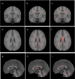 9 brain scans