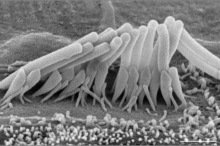 A microscope image of cochlear hair cells