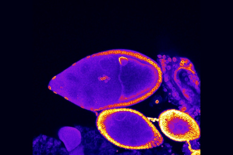 A microscope image of the ovary of a fruit fly