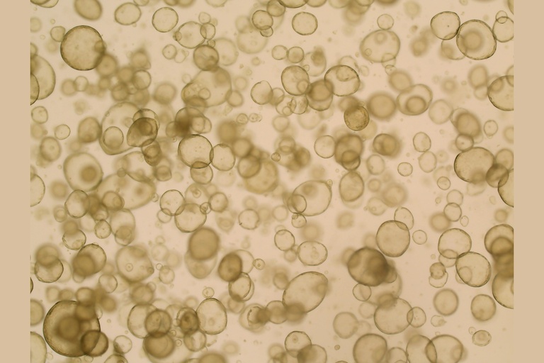 Microscope image of organoids, clusters of cells used to study gynecologic cancers