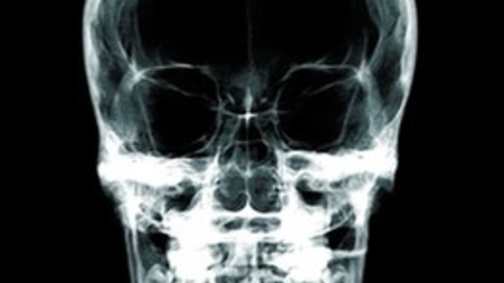 skull x-ray