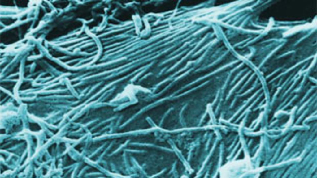 Scanning electron microscopic image of Ebola virions PLOS Biology