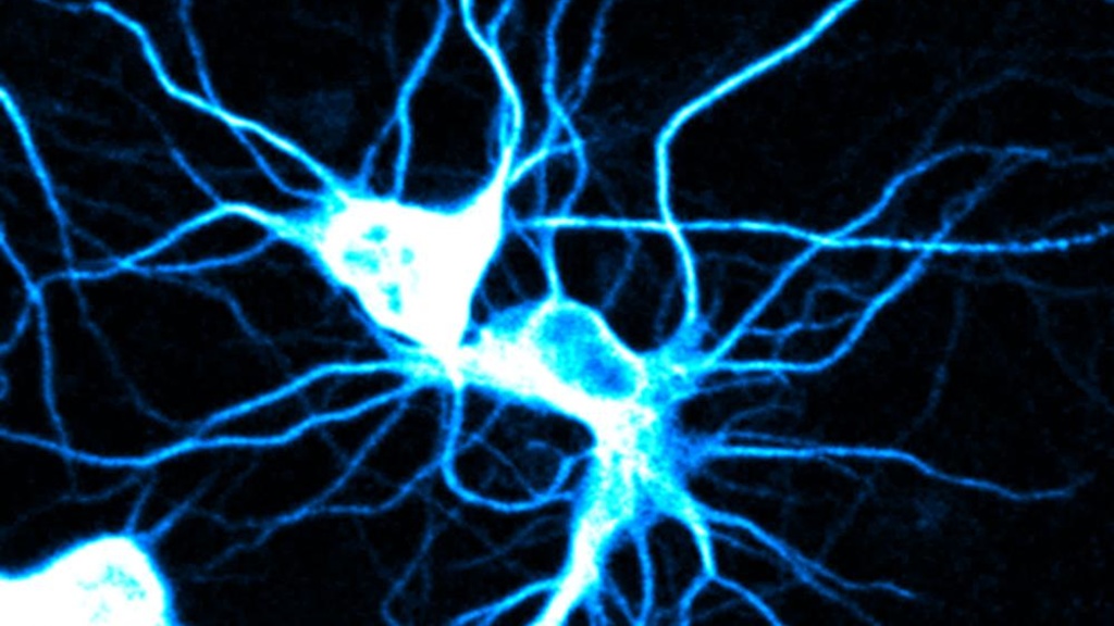 UIHC neuron 1.jpg