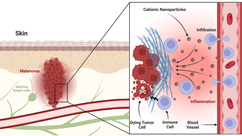 a graphic showing skin with a tumor (melanoma) and other components such as blood and lymphatic vessels; the magnified portion of the graph shows how nanoparticles attract stimulated immune cells to the tumor site (tumor microenvironment)