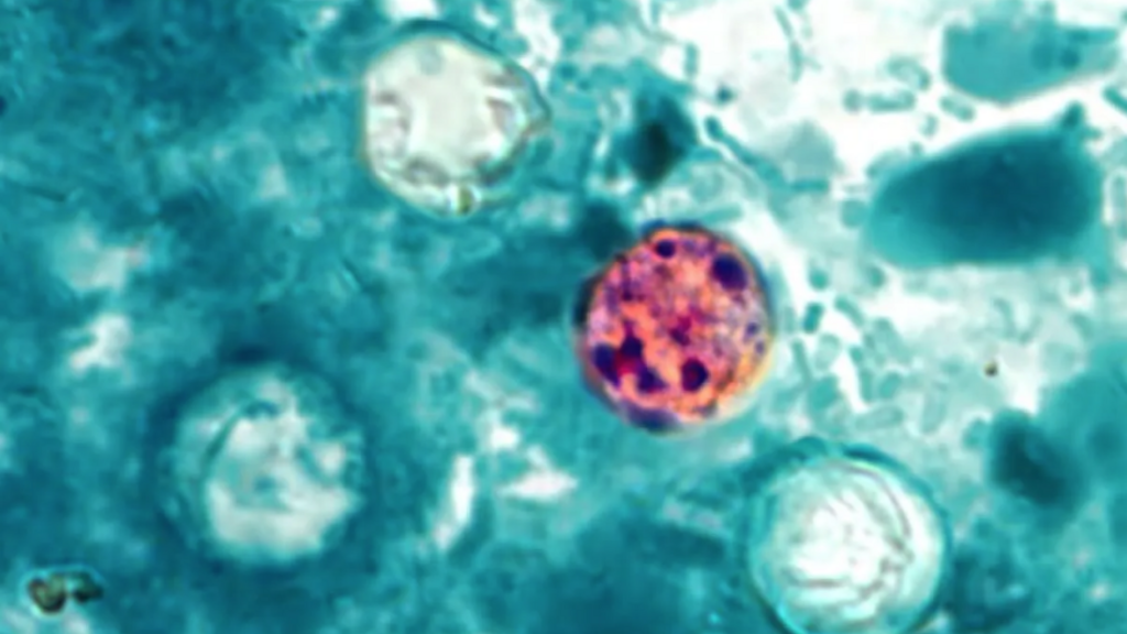 A photo of cyclosporia bacteria taken under a microscope